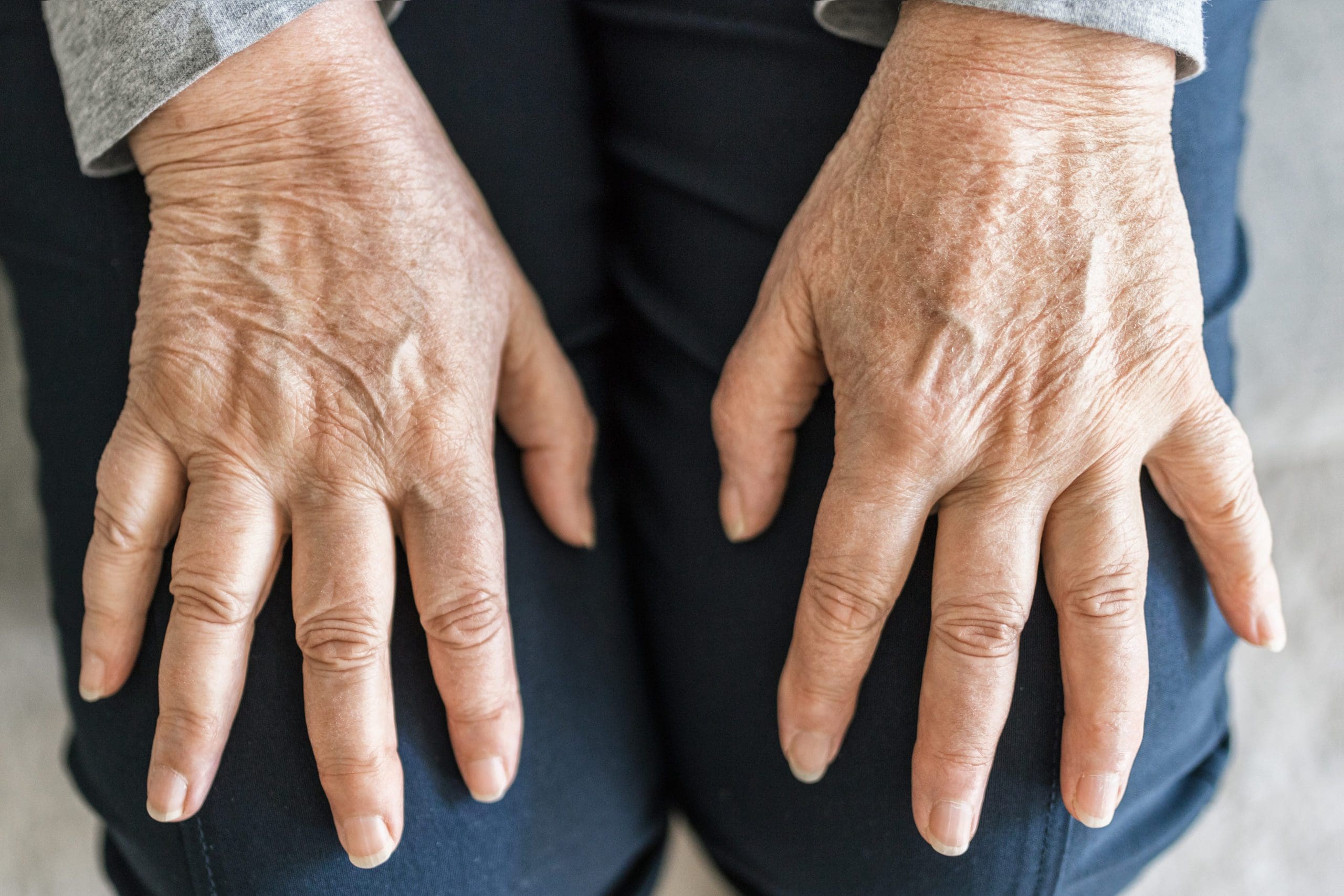Arthritis and Manual Osteopathic Therapy: A Path to Relief